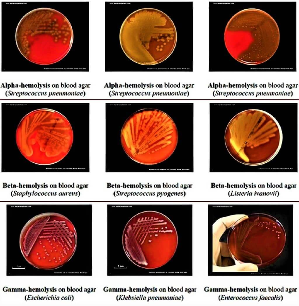 Blood agar plates – hemolysis on blood agar 