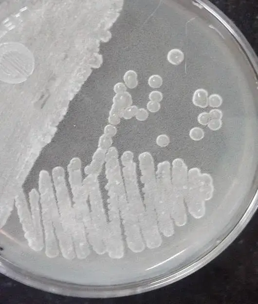 Morphological appearance of two actinomycete isolates grown on Starch Casein Agar