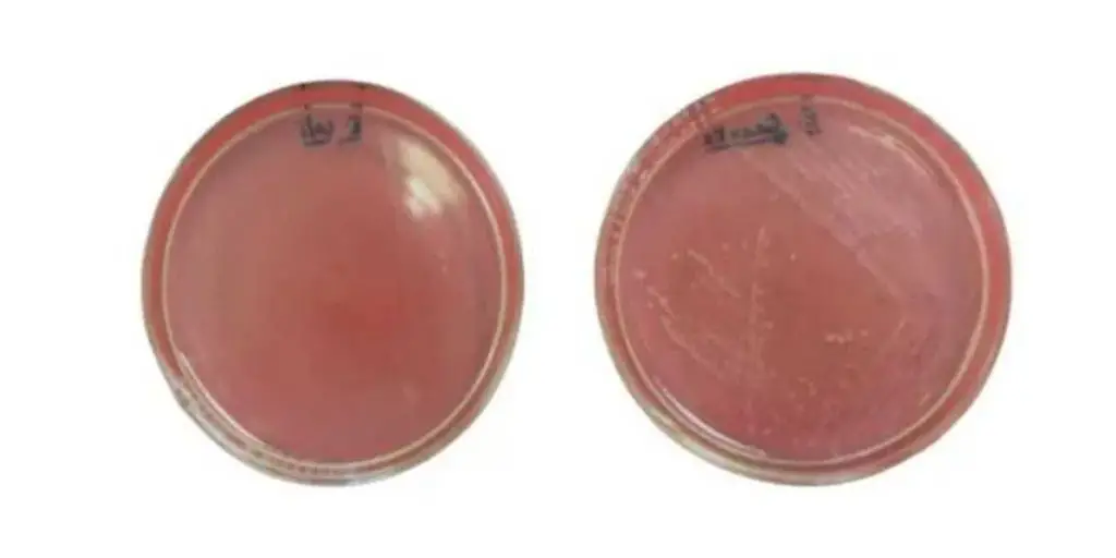 PEA agar plates with 5% sheep blood incubated at 48 hours at 35°C
Left: Escherichia coli. Right: Staphylococcus aureus
Image source: Cheeptham and Farday, ASM MicrobeLibraryPEA agar plates with 5% sheep blood incubated at 48 hours at 35°C
Left: Escherichia coli. Right: Staphylococcus aureus