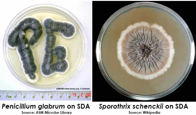 Result Interpretation of Sabouraud Dextrose Agar (SDA)
