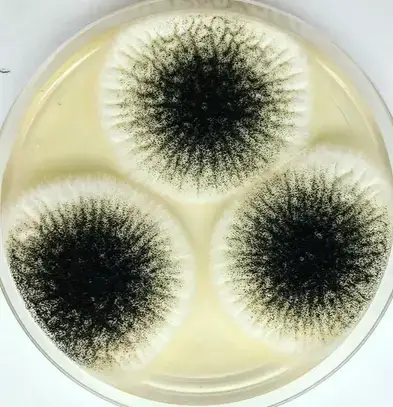 Aspergillus niger on Sabouraud agar (source :@smallbutcool)
