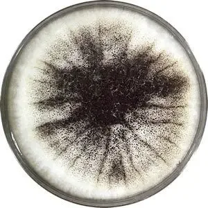 Mold colony with black pigmentation in SDA
