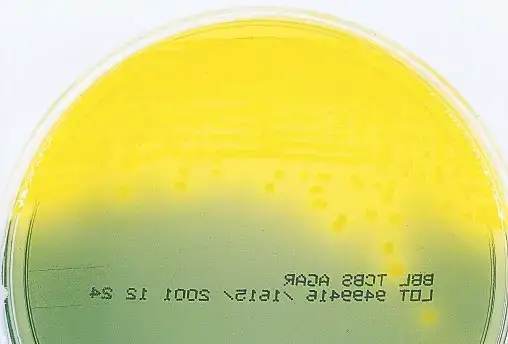 Vibrio cholerae on TCBS agar
