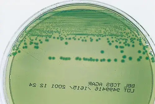 TCBS Agar - Composition, Principle, Preparation, Results, Uses ...