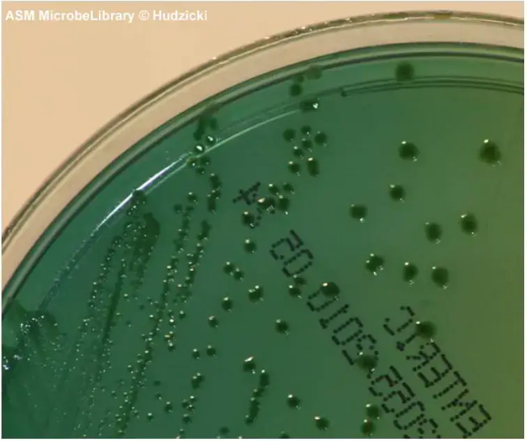 Shigella flexneri – Transparent colonies indicate no carbohydrate utilization and absence of H2S production. On HE agar, all Shigella species have this appearance.