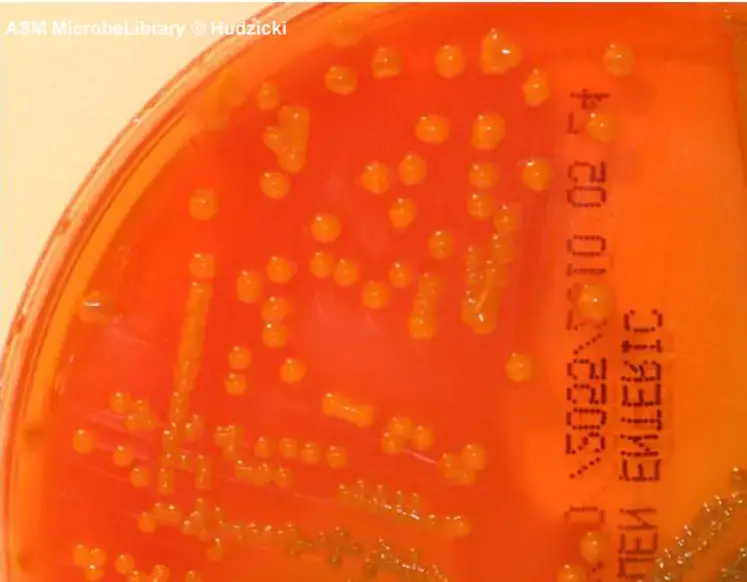 Enterobacter aerogenes – The colonies are orange-yellow, indicating that at least one of the carbohydrates present in the medium is being utilized. No H2S is generated. The orange atmosphere surrounding the colonies is caused by the organism’s precipitation of bile salts. On HE agar, E. aerogenes resembles the majority of nonpathogenic enteric gram-negative rods.