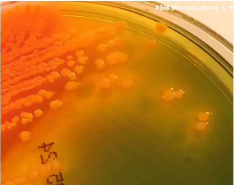 Approximately fifty percent of Proteus vulgaris strains ferment salicin. The colonies are yellower and flattened than those of Enterobacter aerogenes. The bile salts are not precipitated by this organism.
