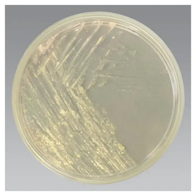 Middlebrook Agar - Composition, Principle, Preparation, Results, Uses ...