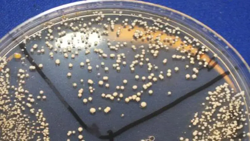 Mycobacterium salmoniphilum colonies on Middlebrook 7H10 agar after 5 days incubation at 22ºC.
