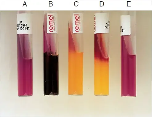 Result Interpretation on Lysine Iron Agar (LIA) – A: Alkaline slant and alkaline butt (K/K)
B: Alkaline slant/alkaline butt, H2S positive (K/K, H2S)
C: Alkaline slant/acid butt (K/A)
D: Red slant/acid butt (R/A)
E: Uninoculated tube