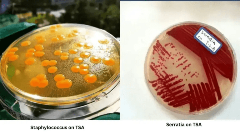 Tryptic Soy Agar TSA Composition Principle Preparation Results Uses Tryptic Soy Agar TSA Composition Principle Preparation Results Uses