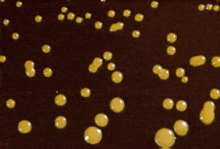 Colonies of Cryptococcus neoformans in birdseed agar
