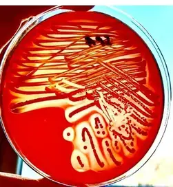 Beta hemolysis
