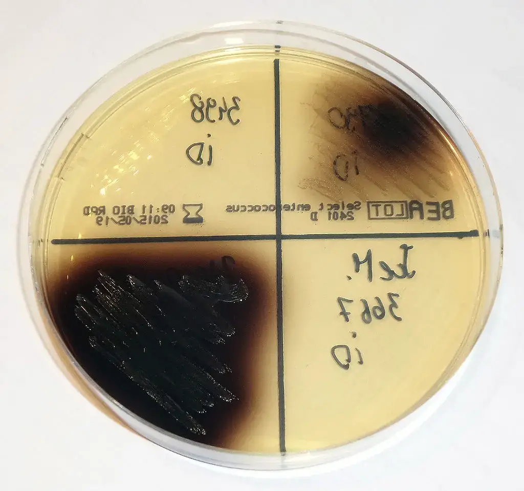 Enterococcus colonies (black) growing on BEA
