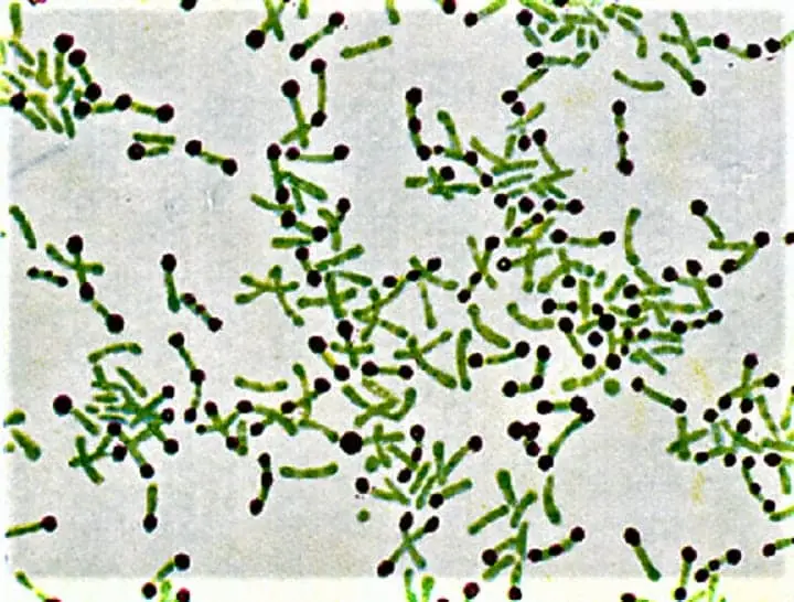 Result and Interpretation of Albert Stain