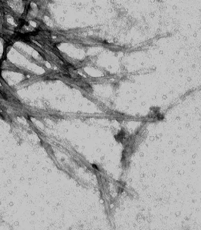 Negative stain of alpha synuclein (Dr. Howard Federoff’s research group)
