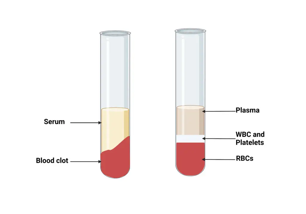 Differences between Serum and Plasma – Serum vs Plasma | Image Credit: Microbiologynote.com, design With Biorender.com
