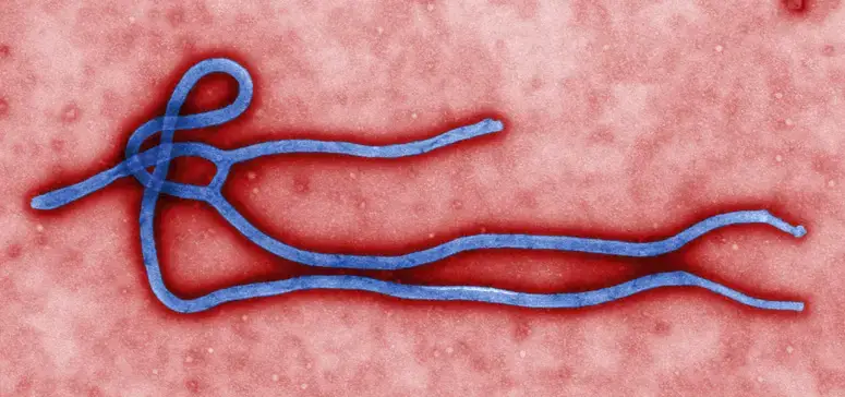 What is Ebola ?
