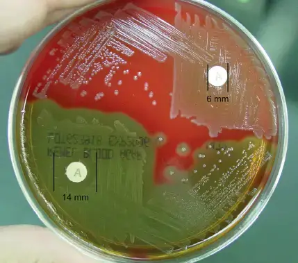 Bacitracin (A disk) susceptibility. Any zone of inhibition is positive (Streptococcus pyogenes); growth up to the disk is negative (Streptococcus agalactiae)
