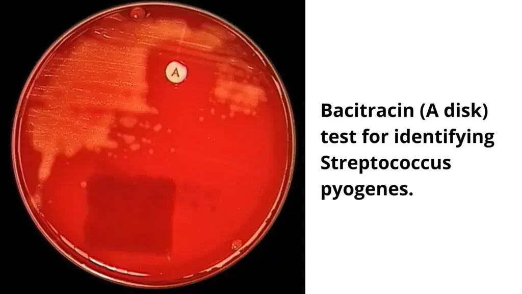 Bacitracin (A disk) test for identifying Streptococcus pyogenes. 