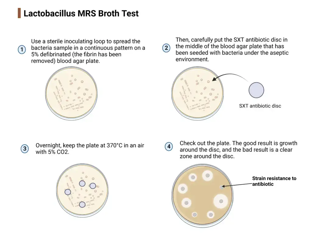 Procedure of SXT Test
