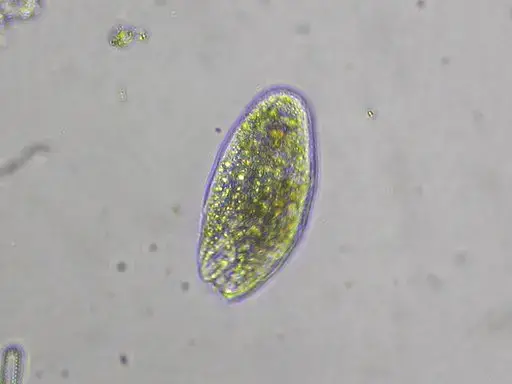 Protozoa By Donald Hobern from Copenhagen, Denmark (Protozoa sp.)