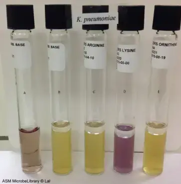 Moeller’s Decarboxylase media. A: Uninoculated base, B: Base inoculated withKlebsiella pneumoniae, C: Arginine broth inoculated with K. pneumoniae, D: Lysine broth inoculated with K. pneumoniae, E: Ornithine broth inoculated with K. pneumoniae. Purple color in tube D indicates that K. pneumoniae is lysine decarboxylase positive while yellow color in tubes C and E (absence of purple color) indicates that it is arginine and ornithine decarboxylase negative 