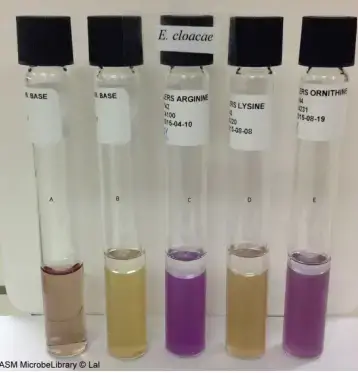 Moeller’s Decarboxylase media. A: Uninoculated base, B: Base inoculated with Enterobacter cloacae, C: Arginine broth inoculated with E. cloacae, D: Lysine broth inoculated with E. cloacae, E: Ornithine broth inoculated with E. cloacae. Purple color in tubes C and E indicate that E. cloacae is arginine and ornithine decarboxylase positive while yellow color in tube D (absence of purple color) indicates that it is lysine decarboxylase negative. 