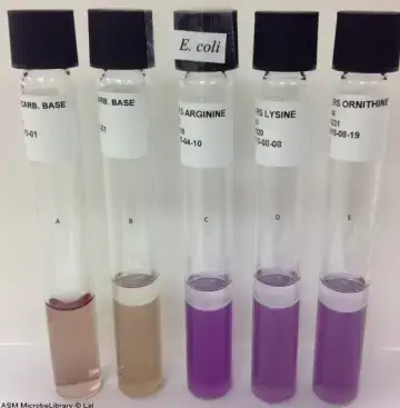 Moeller’s Decarboxylase media. A: Uninoculated base, B: Base inoculated with E. coli, C: Arginine broth inoculated with E. coli, D: Lysine broth inoculated with E. coli, E: Ornithine broth inoculated with E. coli. Purple color in tubes C, D, and E indicate that this strain of E. coli is arginine, lysine, and ornithine decarboxylase positive.