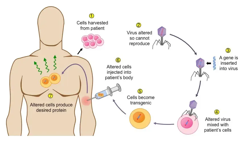 Gene Therapy
