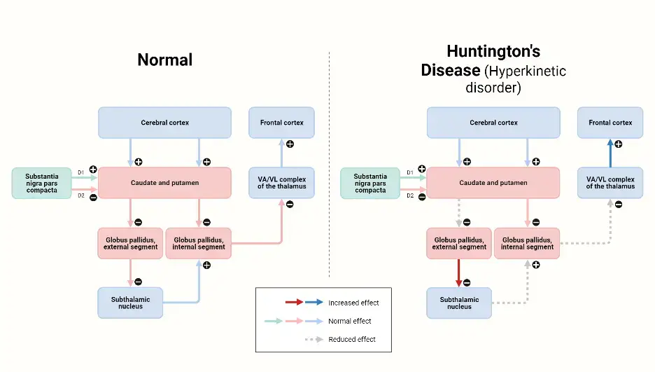 Huntington’s Disease | Created with BioRender.com
