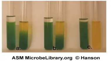 Interpretation and results of OF (Oxidation-Fermentation) Test