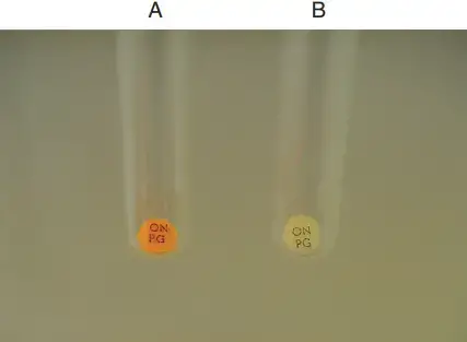 ONPG Test Result – o-Nitrophenyl-b-D-galactopyranoside (OPNG) test.
A, Positive. B, Negative.