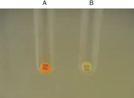 ONPG Test Result – o-Nitrophenyl-b-D-galactopyranoside (OPNG) test.
A, Positive. B, Negative.