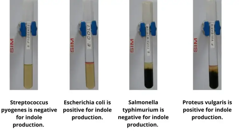 Sulfur Reduction Test - Principle, Purpose, Procedure, Result - Biology ...