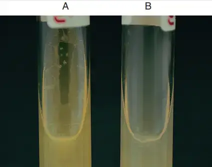 Growth at 42°C. A, Positive; good growth. B, Negative; no growth. | Source: Bailey & Scott’s Diagnostic Microbiology
