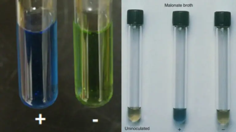 Malonate Test - Principle, Procedure, Results - Biology Notes Online