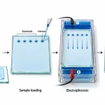 Four-stage rocket immunoelectrophoresis procedure showing antibody-containing agarose preparation, antigen sample loading, electrophoresis, and visualization of precipitin rockets.