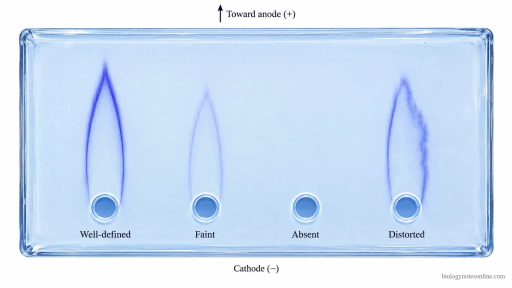Agarose gel showing four rocket immunoelectrophoresis results: a well-defined precipitin rocket, faint rocket, absent rocket, and irregular distorted rocket.