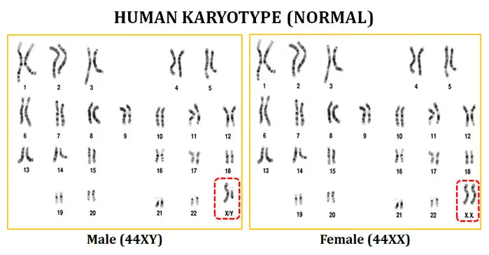 Human karyotype
