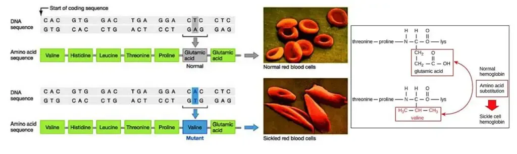 Sickle cell hemoglobin
