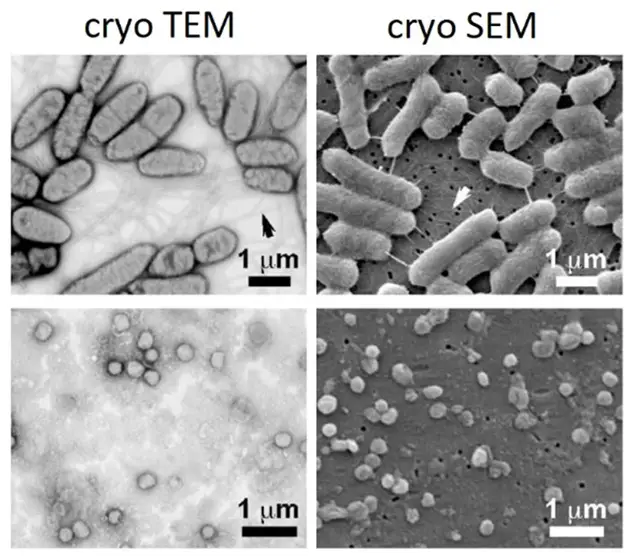 Examples of images obtained with cryo TEM (left) and cryo SEM (right) of Salmonella Senftenberg (upper row) and vaccinia virus (lower row). 