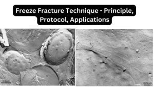 Freeze Fracture Technique – Principle, Protocol, Applications