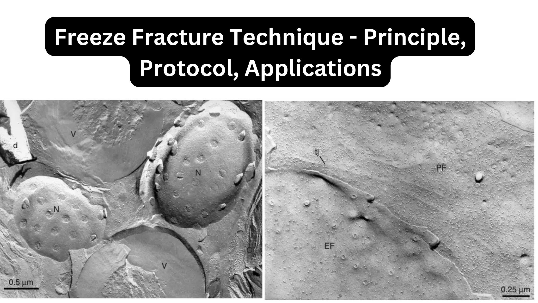 Freeze Fracture Technique - Principle, Protocol, Applications