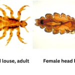 head louse