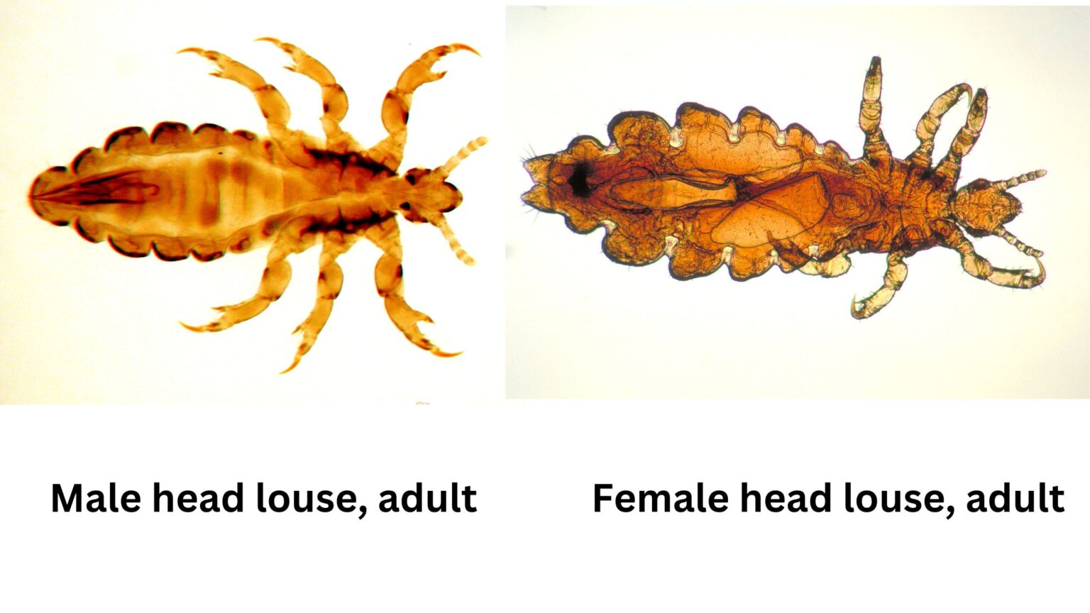 Pediculus Humanus (Lice) - Morphology, Types, Life cycle, Management ...