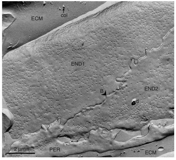 Low-power survey freeze-fracture image of a capillary in heart
muscle.