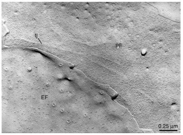 | High-magnification freeze-fracture micrograph illustrating plasma
membrane structure of adjacent endothelial cells.