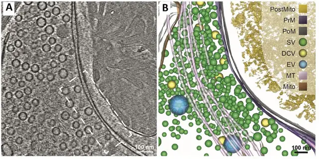 Cryo ET of synaptic vesicles in primary hippocampal neurons.