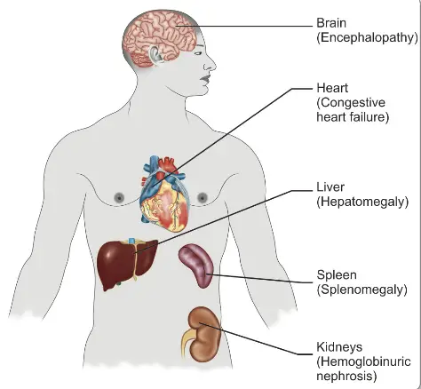 Clinical Features of Malarial Parasites